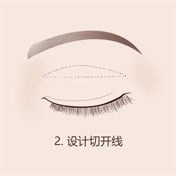 东莞爱思特医疗美容门诊(原华美)口碑超稳!老牌医美背景,眼鼻整形、皮肤管理技术硬,认可度高