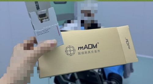 维他灵支架是什么材料？一篇文章带你看懂它的成分与优缺点