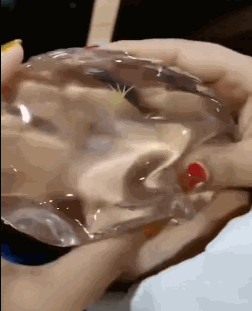 丰胸手术傲诺拉隆胸假体手感.gif 丰胸手术傲诺拉隆胸假体手感.gif