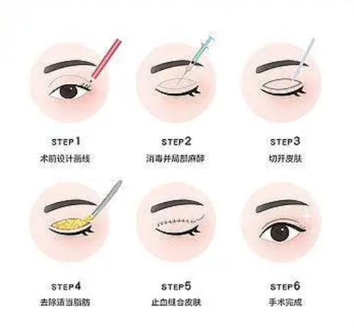 温州艺启美医疗美容门诊部口碑好不好？口碑好！医美项目特色，顾客满意度高