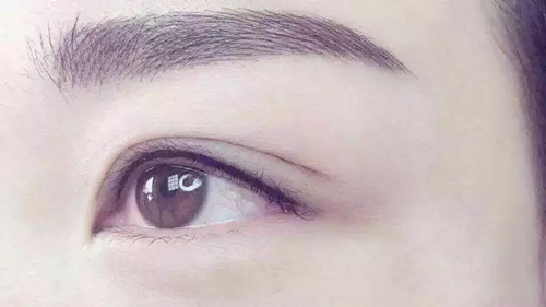 双眼皮实拍 双眼皮实拍