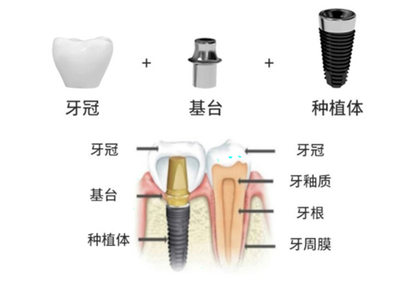 爱尔眼科近视手术预约挂号全攻略：从流程到注意事项一篇通