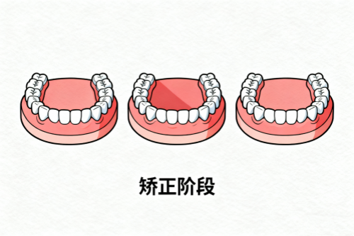 牙齿矫正成果展示.png
