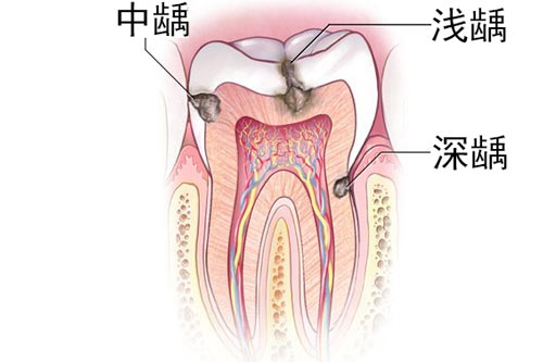 南通牙科医院哪家强？这份超全测评告诉你哪里弄牙齿然靠谱！