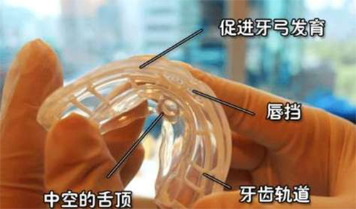 昆明牙齿正畸一般多少钱？2023新版牙齿矫正价格表全解析