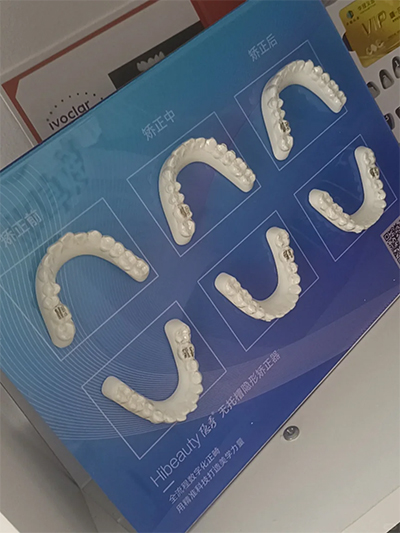 广州牙齿矫正医院排名前十分享 全是正畸好还不贵的牙科