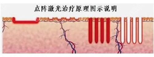 兰州去疤痕哪里比较好？3家口碑技术好的疤痕修复医院盘点
