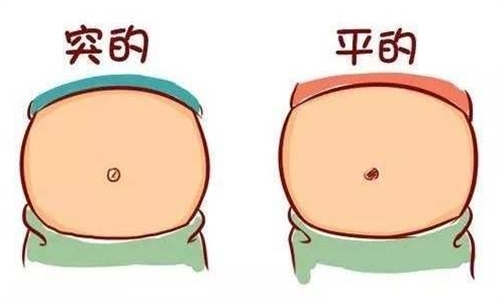 肚脐整形术前后大对比！真人日记告诉你横竖肚脐怎么选非常香