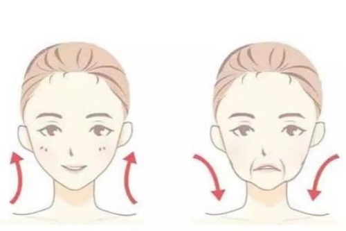 面部脂肪填充卡通对比图 面部脂肪填充卡通对比图