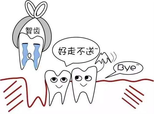 2024天水拔智齿价格全攻略：上颌500+起，横生智齿竟要2000+？
