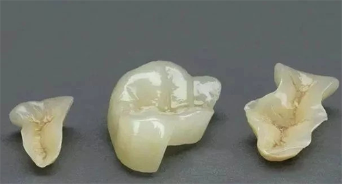 厦门洗牙哪里比较好？洗牙能用***卡吗？真人体验分享