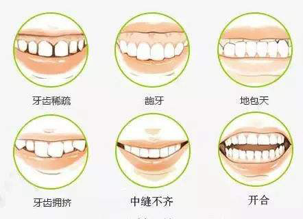 重庆奉节牙齿矫正医院哪家强？这份排名榜帮你避坑选对！