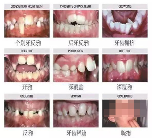 成都牙齿矫正医院排名前十，特色正畸牙科大盘点！