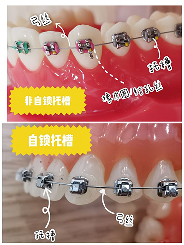 遵义牙齿矫正医院排名榜出炉！性价比较高的正畸牙科都在这了