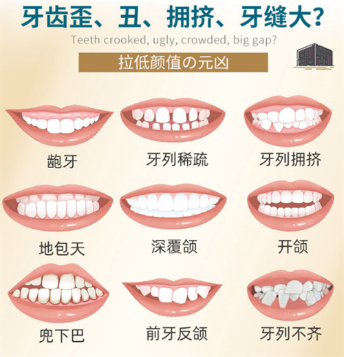 12岁儿童牙齿矫正费用大揭秘！牙套价格全解析，家长必看指南