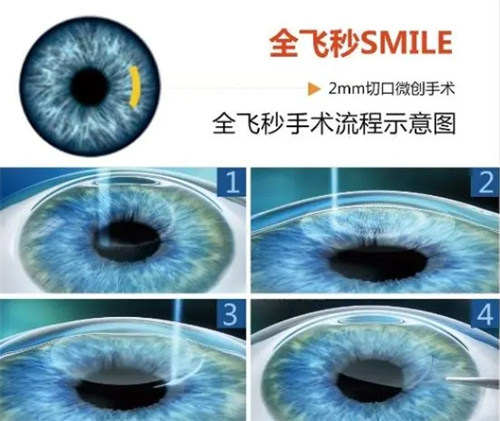 扬中明辰眼科医院怎么样？值得选！本地口碑好，验光配镜、眼病治疗细致又较高的效率