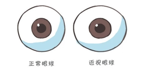 三明市第三医院眼科价格表查询，近视矫正10000元起/白内障6000起/青光眼3000起！