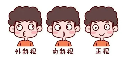 普瑞眼科医院做斜视手术靠谱吗？可靠解读+真实体验分享