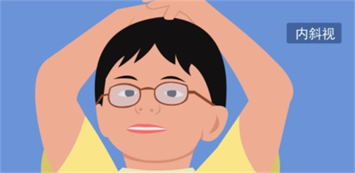 爱尔眼科斜视手术费用大揭秘：价格、成效、注意事项全解析