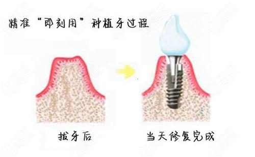 济宁看牙收费不高！费用标准公开牙齿矫正/种植牙价格大揭秘