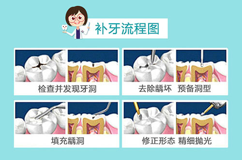 贵港补牙贵吗？想知道贵港哪里补牙齿便宜还好快来看！