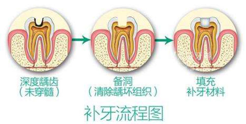 重庆补牙去哪家好？良心推荐5家高性价比牙科诊所