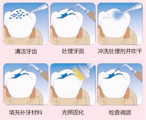 2024广东牙科医院收费指南：种牙/整牙/补牙价格全透明！省钱避坑必看