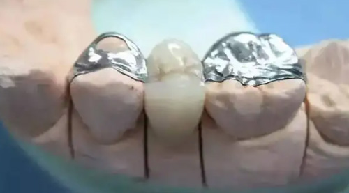 想在北京昌平看牙镶牙？这几家便宜又好的牙科值得一试！